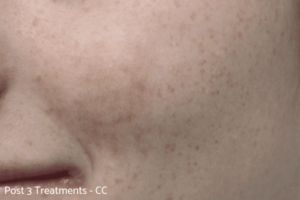 Cafe AU Lait Skin treatment After