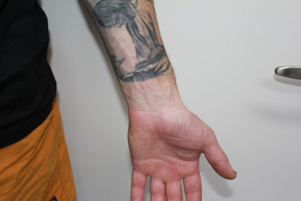 5 Laser Tattoo Removal Myths Busted - Clean Canvas Laser Clinic 5 Laser Tattoo Removal Myths Busted - Clean Canvas Laser Clinic